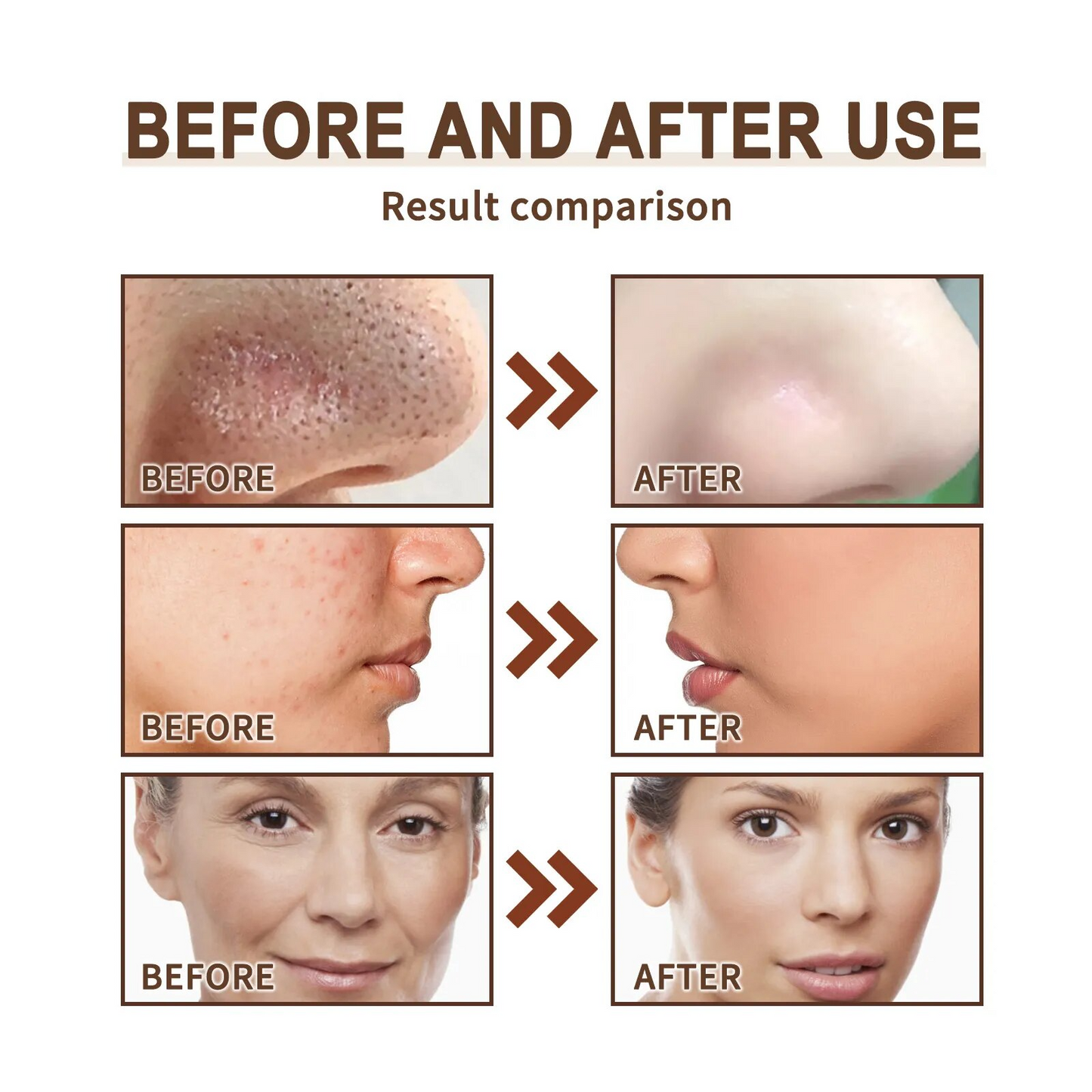Korean Pro-Herbal Refining Peel-Off Facial Mask